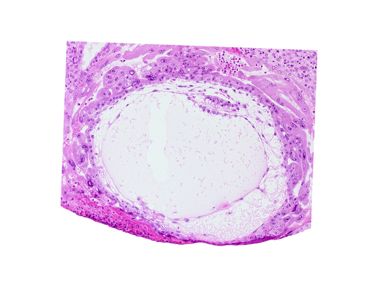 exocoelomic (Heuser's) membrane, extra-embryonic mesoblast, fibrous coagulum, primary umbilical vesicle cavity, uterine cavity