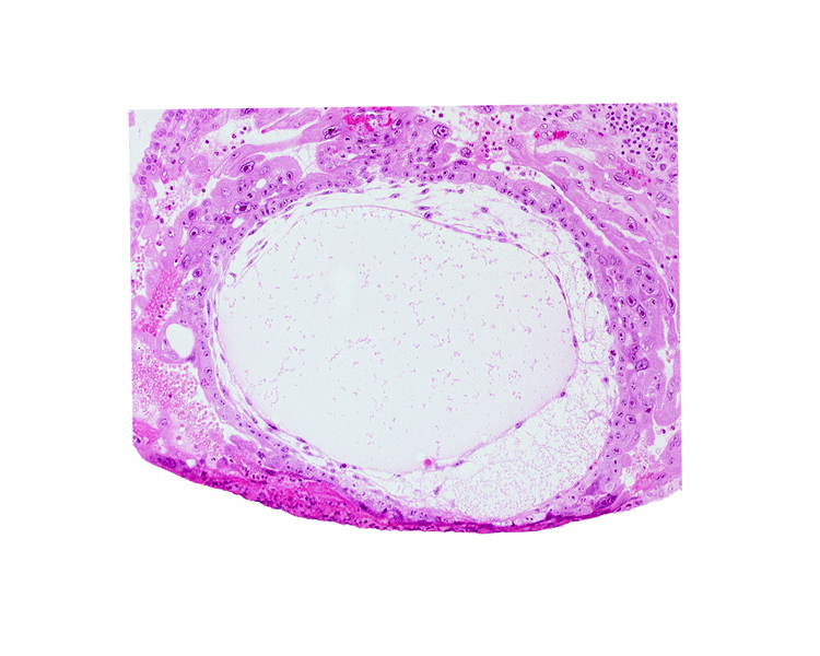 chorionic cavity, exocoelomic (Heuser's) membrane, primary umbilical vesicle cavity, syncytiotrophoblast