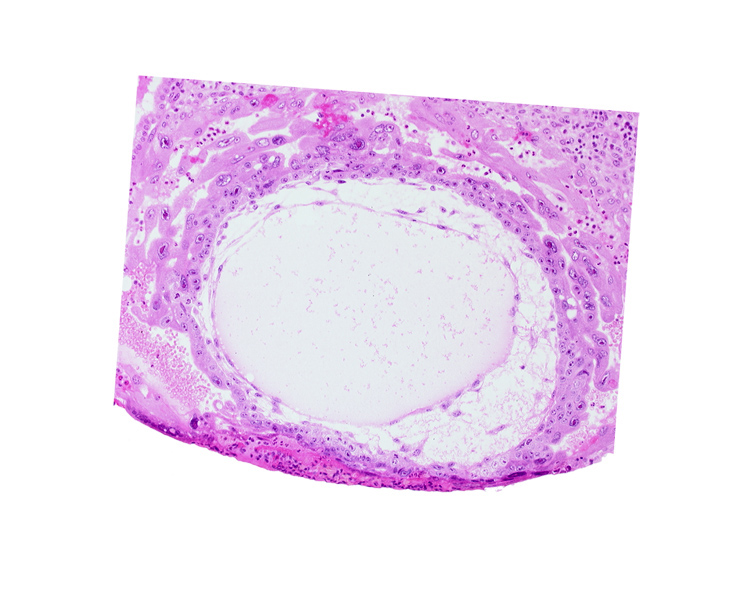 angioblastic tissue, chorionic cavity, cytotrophoblast, definitive exocoelomic (Heuser's) membrane, fibrous coagulum, lacunar vascular circle, previllus crest of mesoblast, previllus mesoblast clump, primary umbilical vesicle cavity, syncytiotrophoblast, uterine cavity