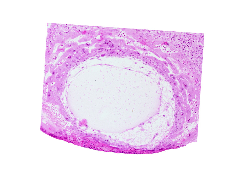 angioblastic tissue, definitive exocoelomic (Heuser's) membrane, fibrous coagulum, lacunar vascular circle, uterine cavity
