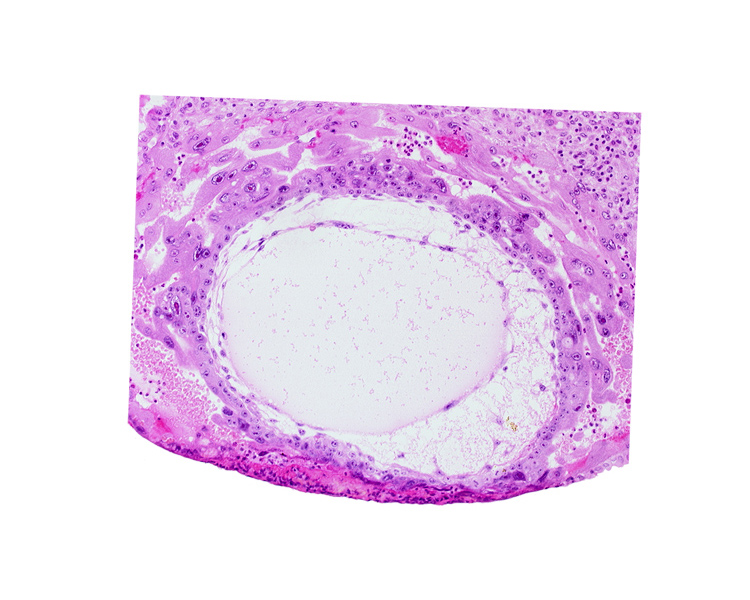 chorionic cavity, lacunar vascular circle, primary umbilical vesicle cavity, syncytiotrophoblast, uterine cavity