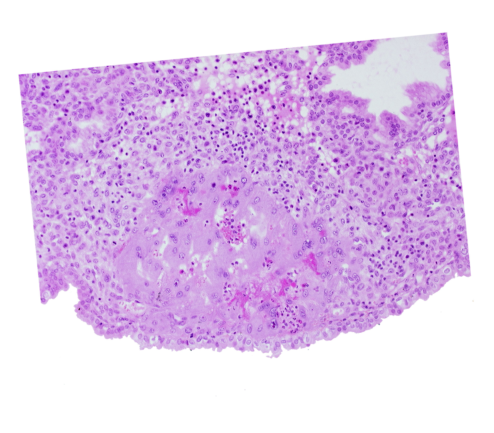 lumen of endometrial gland, maternal blood cells in trophoblast lacuna, syncytiotrophoblast, uterine cavity