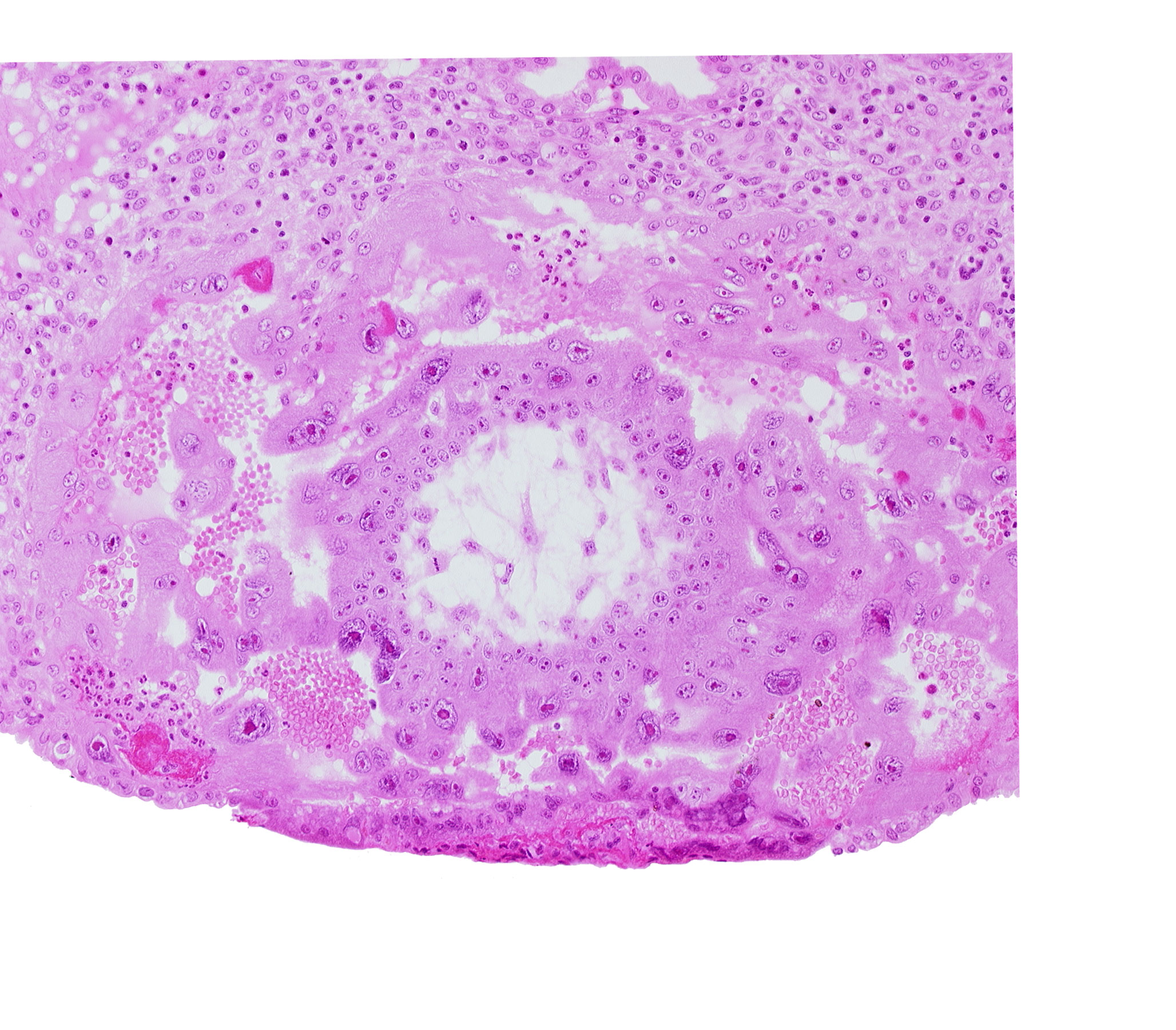 cytotrophoblast, syncytiotrophoblast, uterine cavity