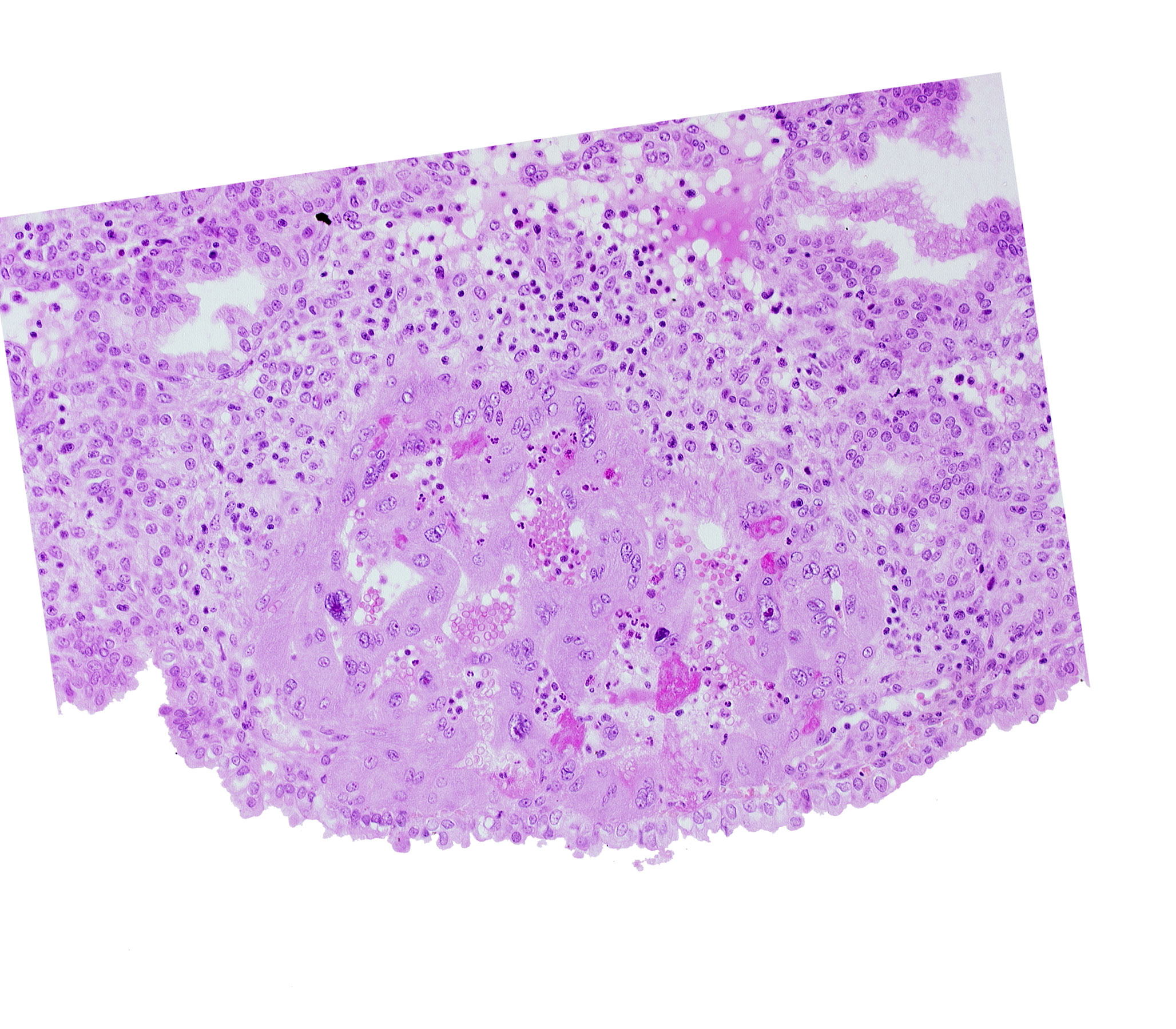 edematous endometrial stroma (decidua), endometrial epithelium, maternal blood cells in trophoblast lacuna, syncytiotrophoblast, syncytiotrophoblast / decidua interface, uterine cavity