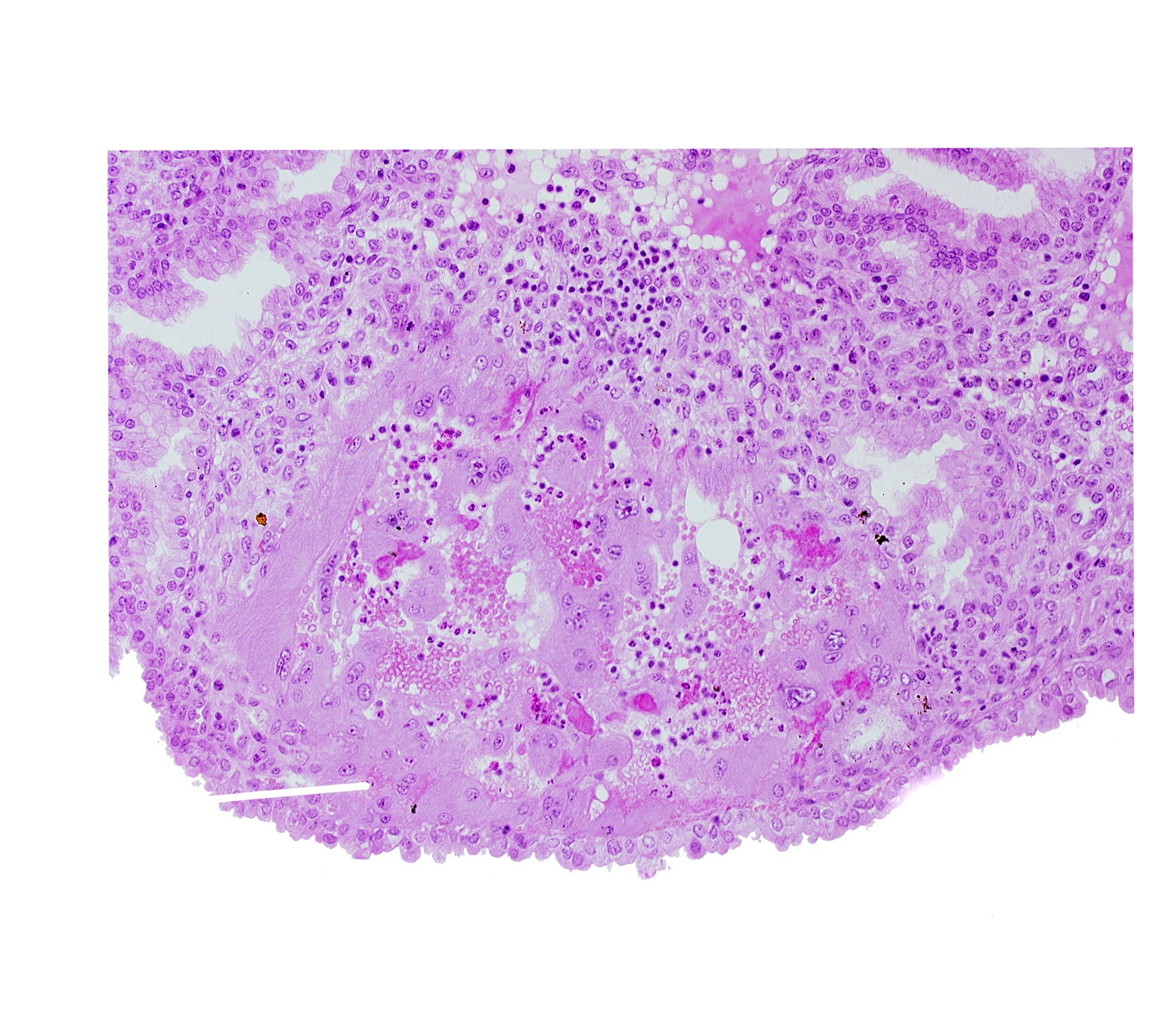 endometrial epithelium, syncytiotrophoblast, uterine cavity