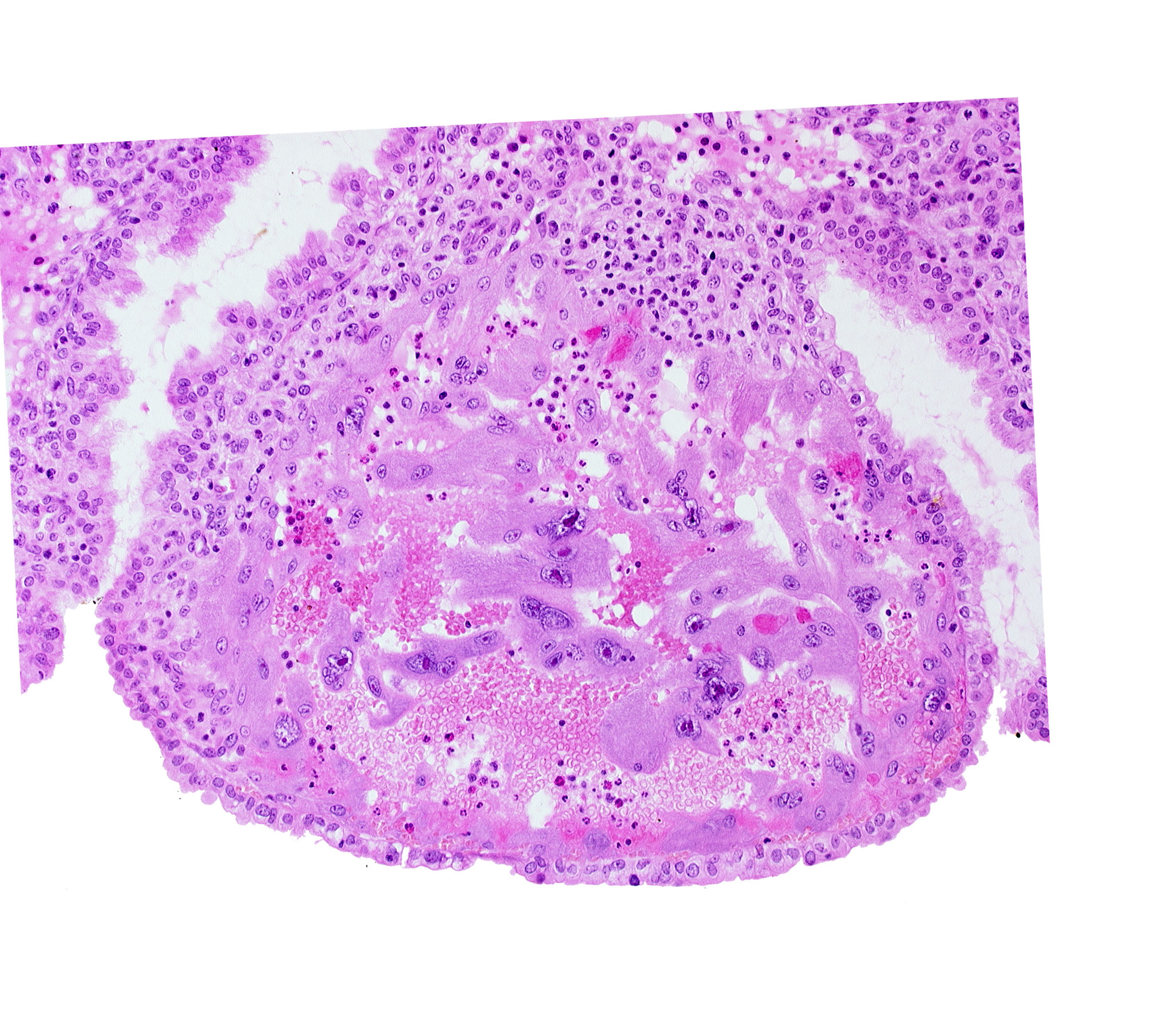 endometrial epithelium, maternal blood cells in trophoblast lacuna, mouth of endometrial gland, syncytiotrophoblast