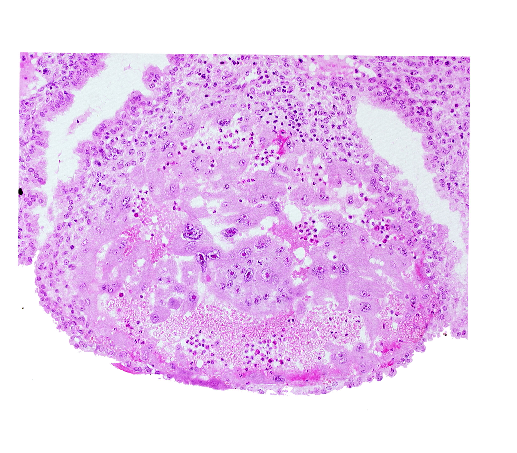 lumen of endometrial gland, maternal blood cells in trophoblast lacuna, syncytiotrophoblast