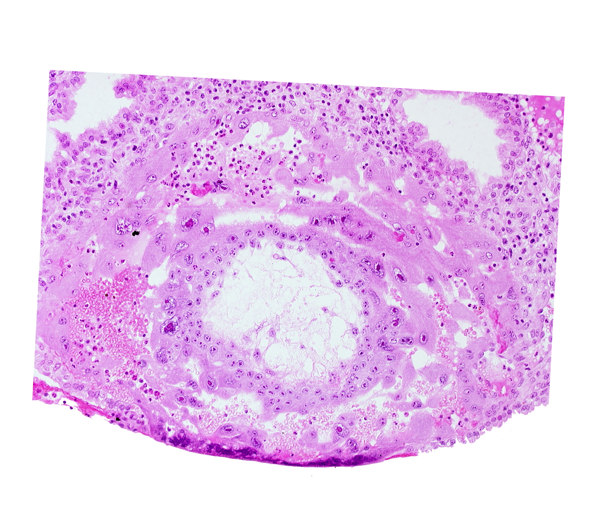 chorion, disrupted endometrial epithelium, extra-embryonic reticulum, lacunar vascular circle, syncytiotrophoblast, uterine cavity