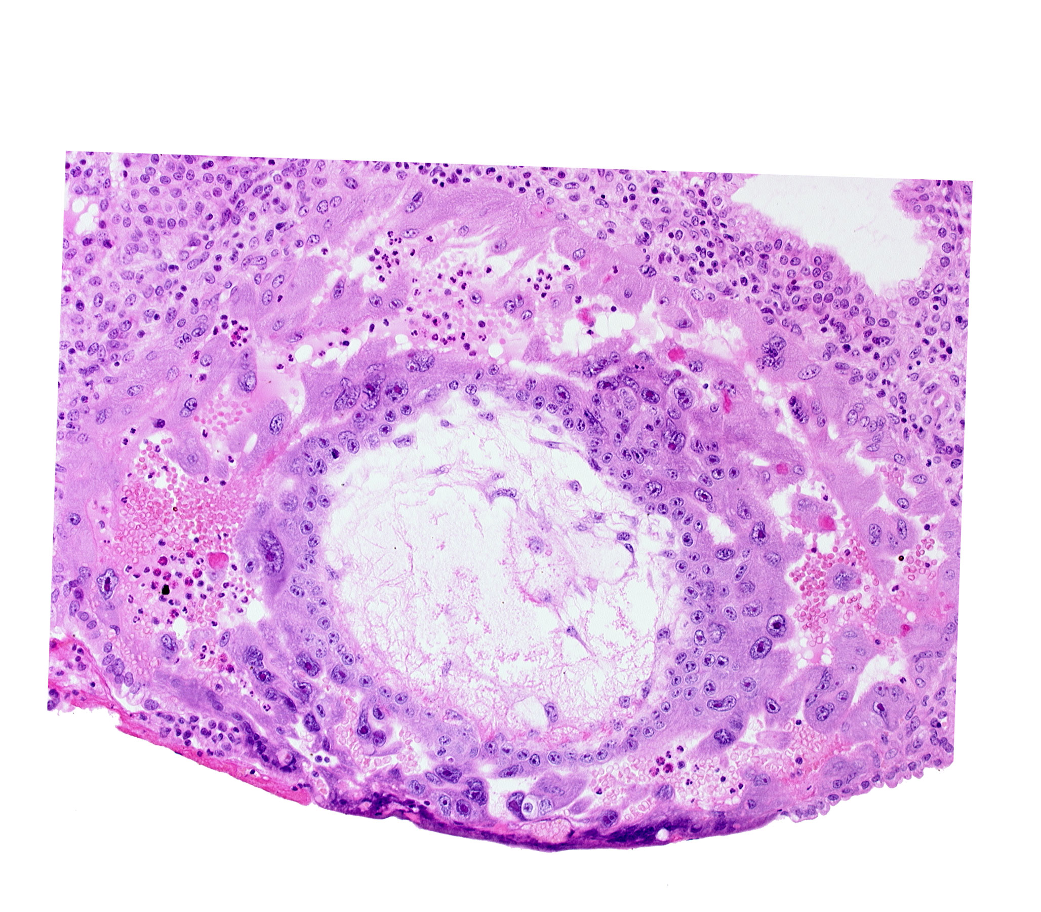 disrupted endometrial epithelium, extra-embryonic reticulum, lacunar vascular circle