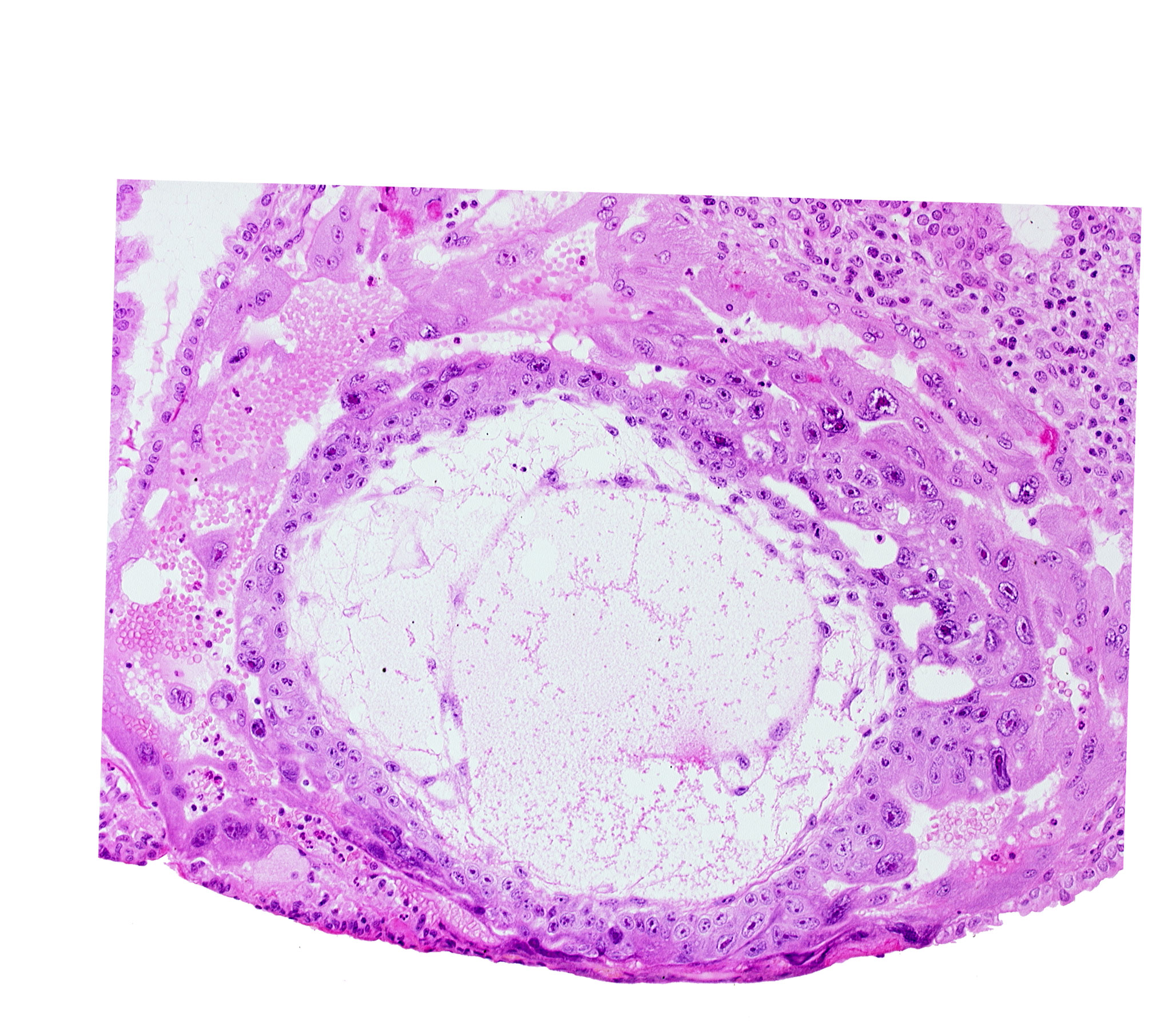 chorionic cavity, extra-embryonic mesoblast, uterine cavity