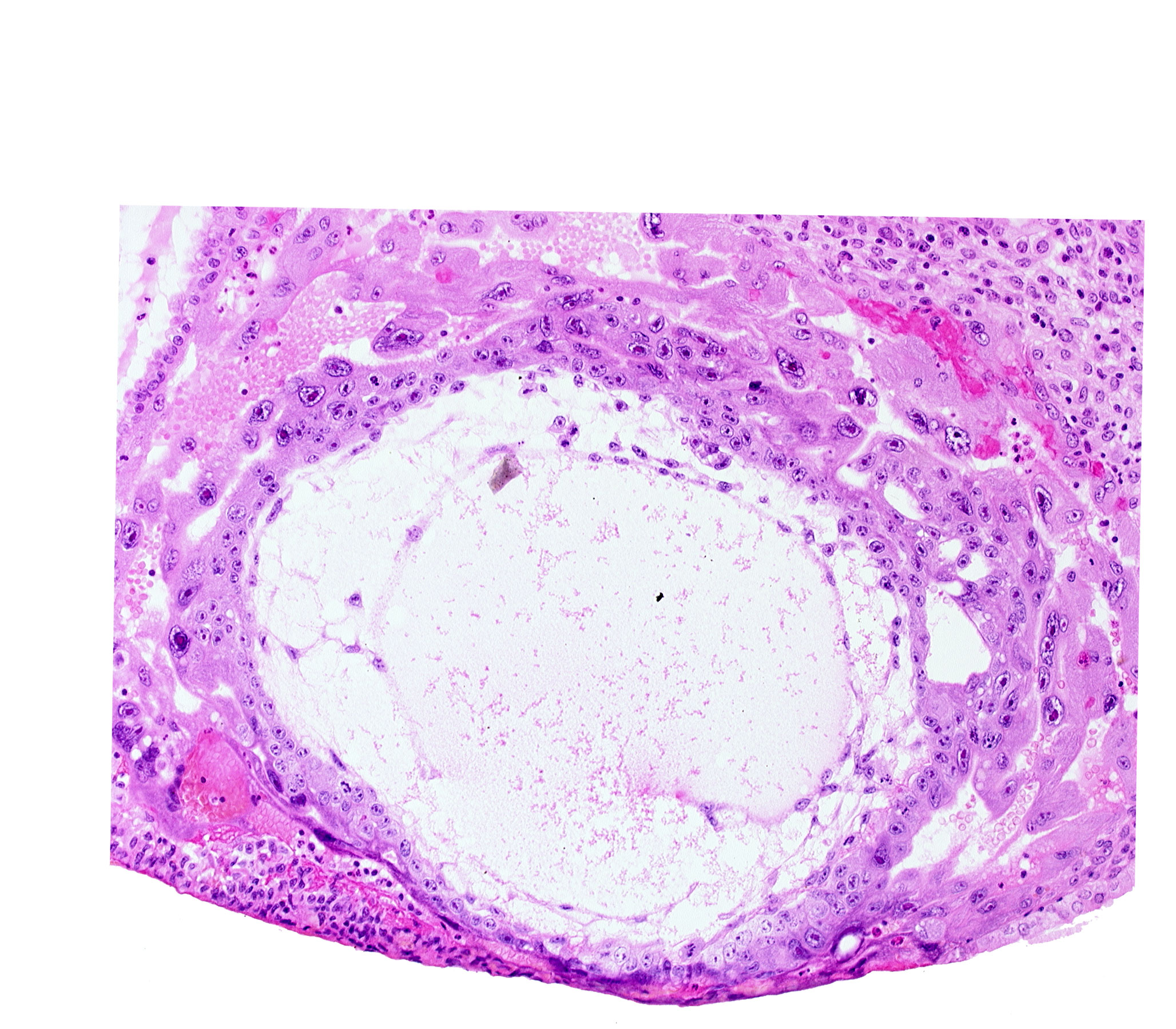 chorionic cavity, cytotrophoblast, extra-embryonic mesoblast, fibrous coagulum, primary umbilical vesicle cavity, syncytiotrophoblast, uterine cavity