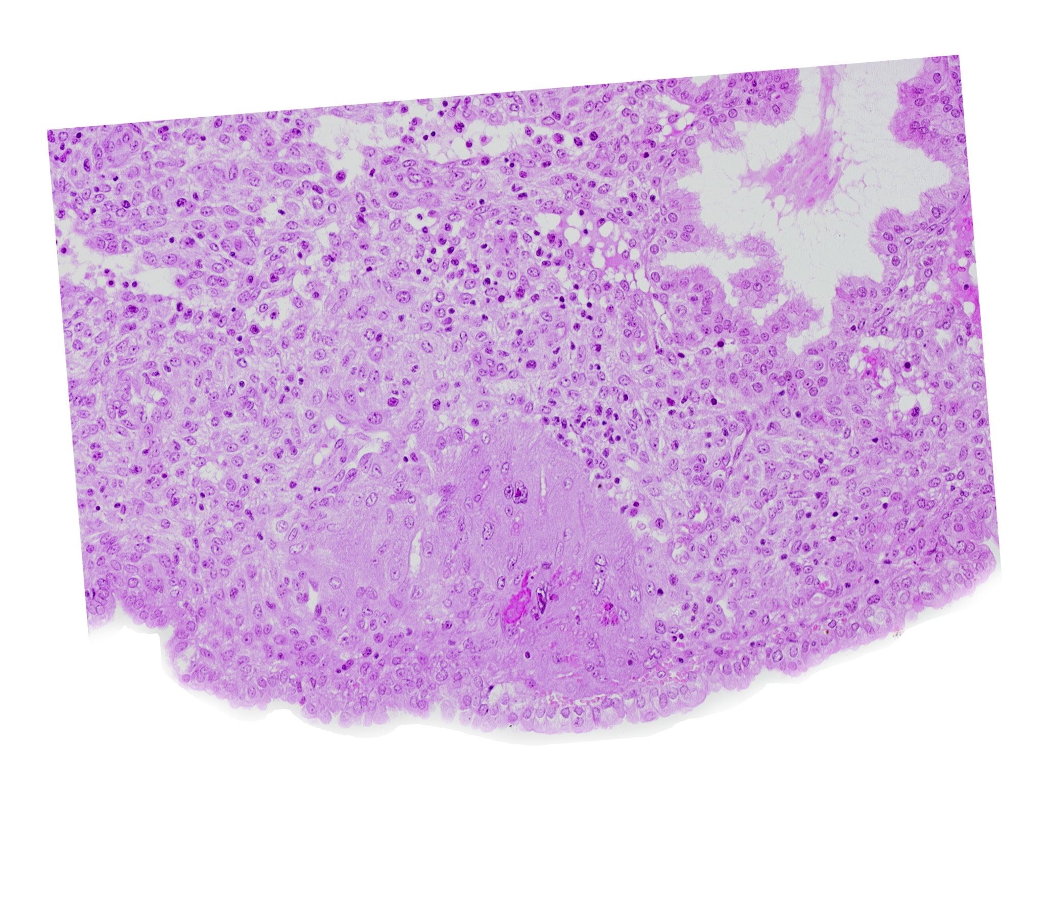 endometrial epithelium, lumen of endometrial gland, syncytiotrophoblast