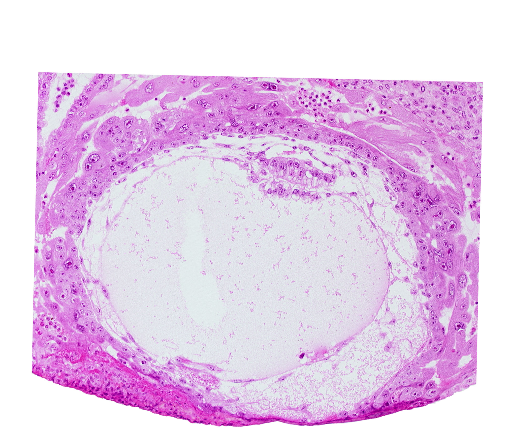 chorionic cavity, condensed extra-embryonic mesoblasts, embryonic disc, endometrial epithelium, epiblast vacuole, exocoelomic (Heuser's) membrane, extra-embryonic mesoblast, fibrous coagulum, hypoblast vacuole, primary umbilical vesicle cavity, uterine cavity