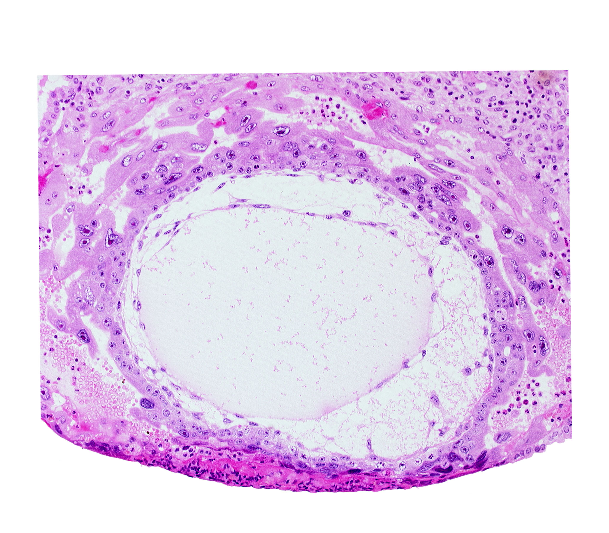 chorionic cavity, primary umbilical vesicle cavity, syncytiotrophoblast, uterine cavity