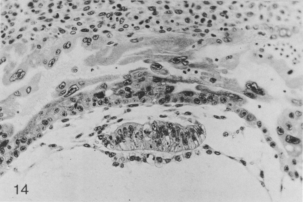 Bilaminar embryonic disc