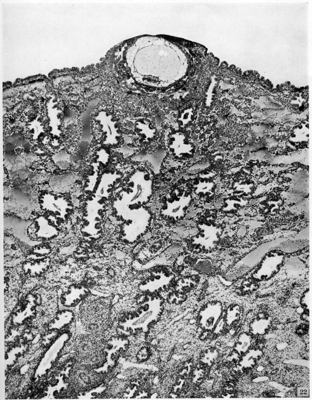 Low-power view of embryo and surrounding endometrium