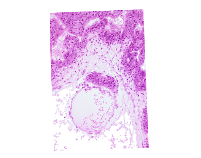 cephalic edge of amnion, cephalic edge of amniotic cavity, embryonic disc, epiblast, hypoblast, secondary umbilical vesicle cavity