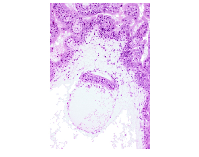 amnion, amniotic cavity, chorionic plate, embryonic disc, intervillus space(s)