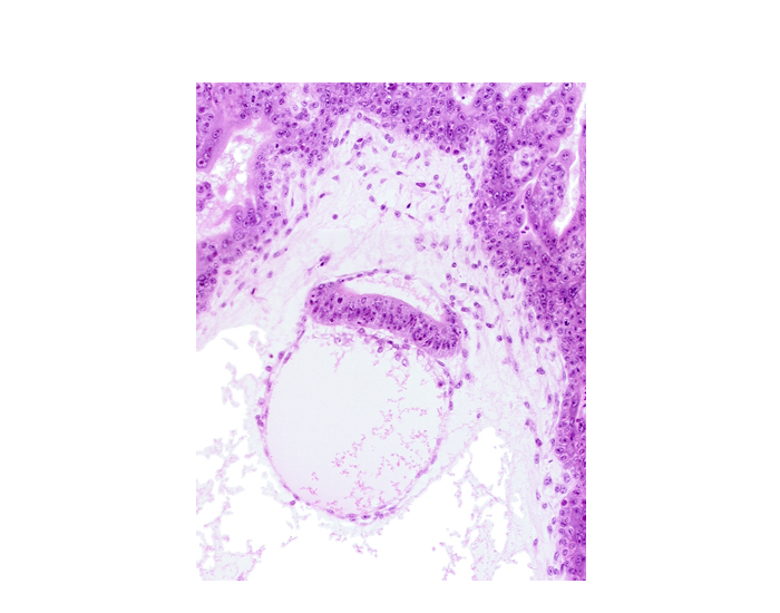 embryonic disc, epiblast, extra-embryonic coelom, head mesenchyme, hypoblast, secondary umbilical vesicle cavity