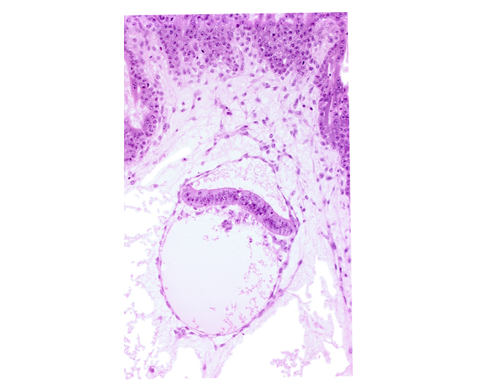 amnion, clump of cells in hypoblast, extra-embryonic coelom, intervillus space(s), junction of extra-embryonic endoderm and hypoblast, secondary umbilical vesicle process