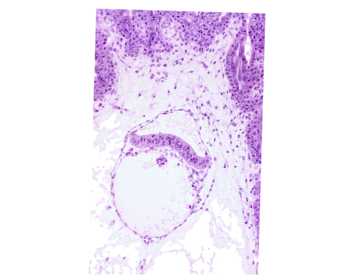 clump of cells in hypoblast, epiblast, extra-embryonic endoderm, head mesenchyme, mesoblast (mesenchyme)