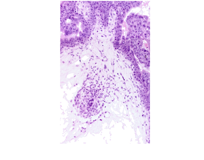 chorion, endodermal mass, hemangioblastic tissue, intervillus space(s), primordial connecting stalk, secondary umbilical vesicle process, syncytiotrophoblast