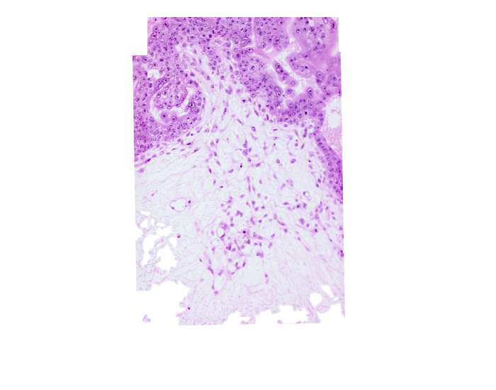 cytotrophoblast, extra-embryonic coelom, mesoblast (mesenchyme) core of secondary stem villus, mesoblast(s) in caudal wall of secondary umbilical vesicle, primordial blood vessel(s), primordial connecting stalk, primordial germ cell(s), syncytiotrophoblast