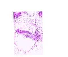 Median sagittal plane - Section