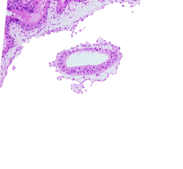 amniotic cavity, chorionic cavity, mesoblast