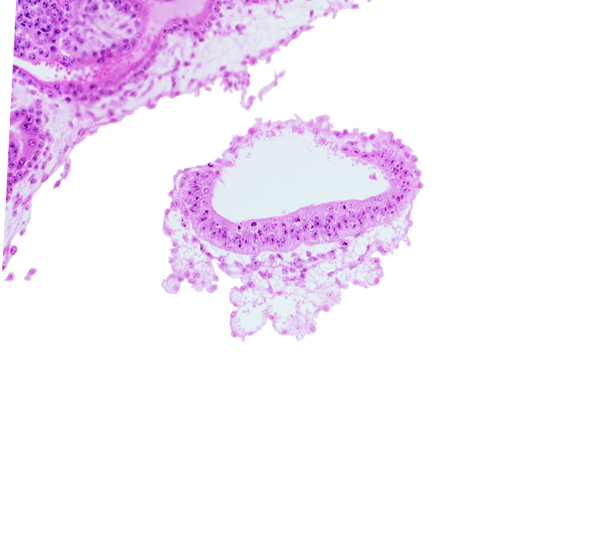 amnion, cephalic part of connecting stalk, head mesenchyme