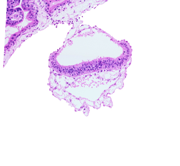 amniotic cavity, connecting stalk, epiblast, head mesenchyme, hypoblast, mesoblast (mesenchyme), mesothelium, primordial germ cell(s), two-layered umbilical vesicle wall, umbilical vesicle cavity