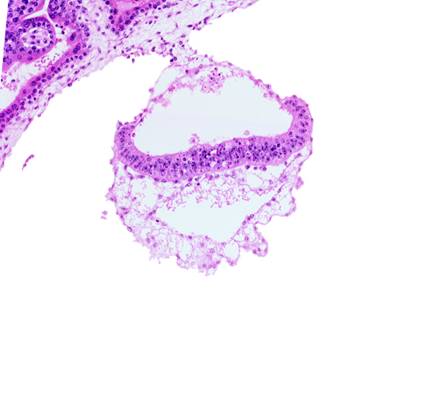 amniotic cavity, connecting stalk, extra-embryonic endoderm, mesothelium, two-layered umbilical vesicle wall, umbilical vesicle cavity