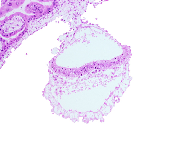 amniotic cavity, connecting stalk, epiblast, hypoblast, notochordal process, presumptive neural plate, umbilical vesicle cavity
