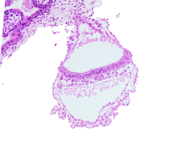 cephalic edge of amniotic duct, connecting stalk, embryonic endoderm, embryonic mesoderm, epiblast, extra-embryonic ectoderm, extra-embryonic endoderm, gastrulation (primitive) streak, umbilical vesicle cavity