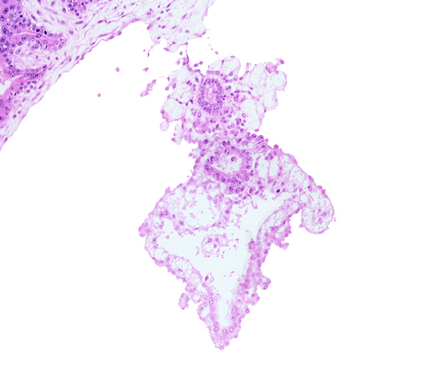 allantoic diverticulum (duct), caudal edge of amniotic cavity, cloacal membrane, embryonic endoderm, epiblast, internal cyst, umbilical vesicle cavity