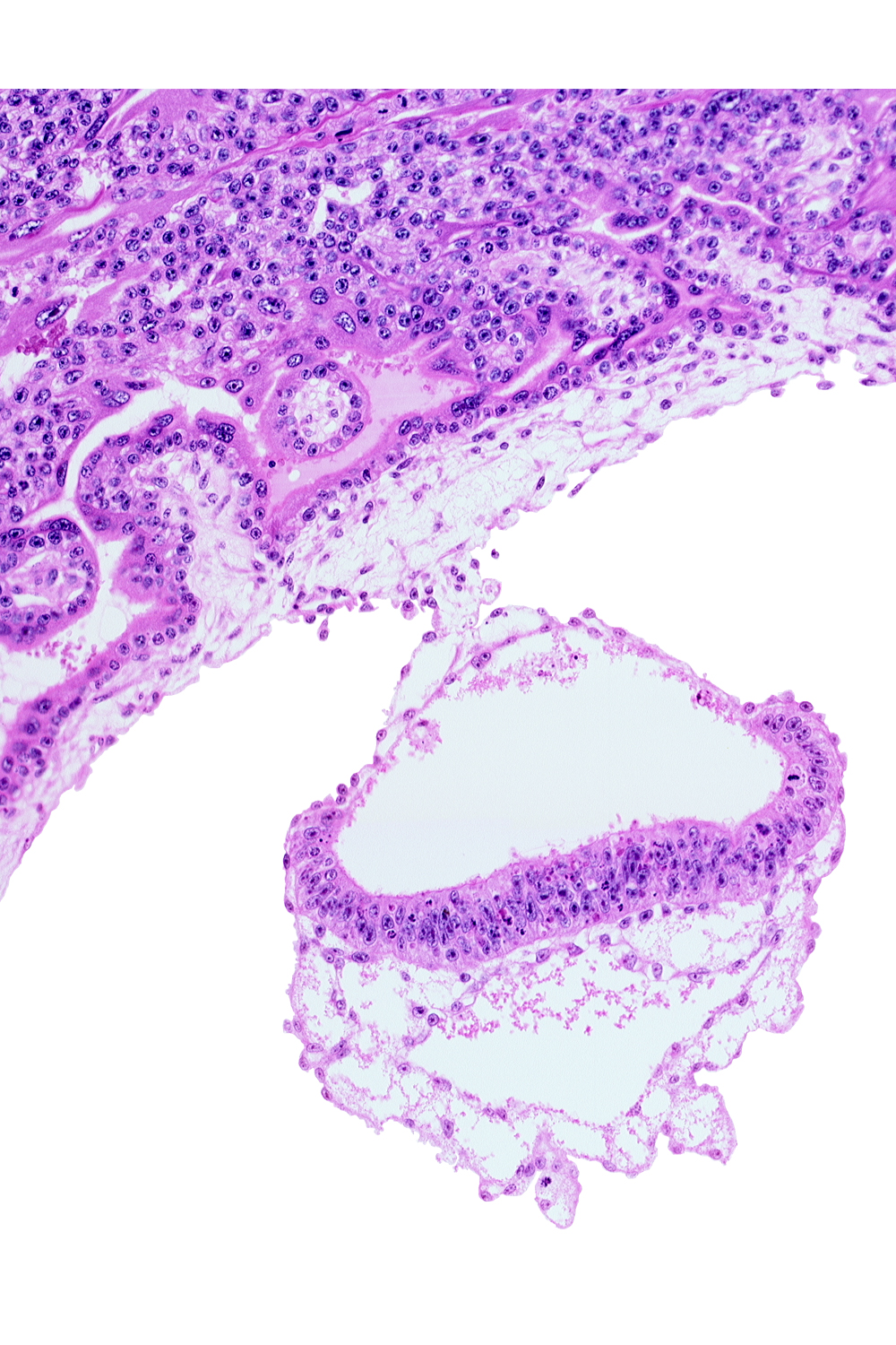 amniotic cavity, connecting stalk, epiblast, head mesenchyme, hypoblast, mesoblast (mesenchyme), mesothelium, primordial germ cell(s), two-layered umbilical vesicle wall, umbilical vesicle cavity