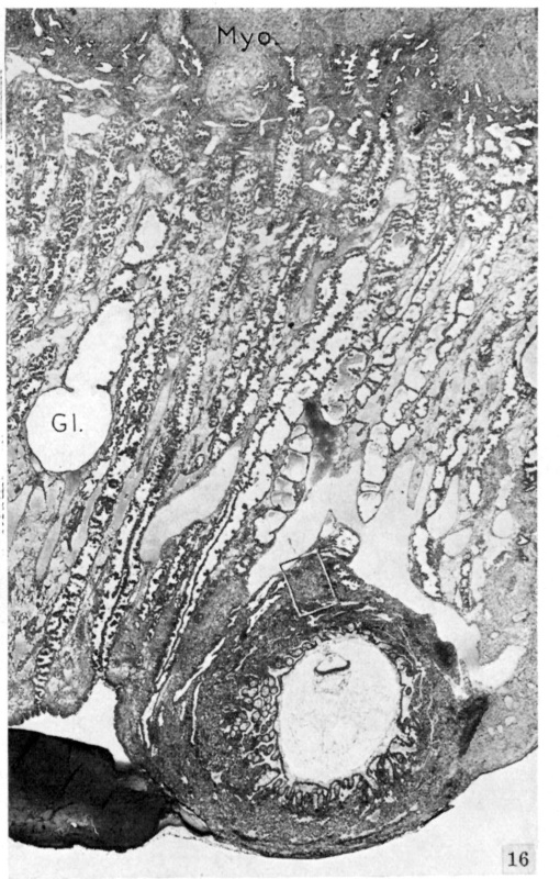 Section through the implanted embryo