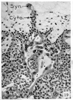 Cytotrophoblast 