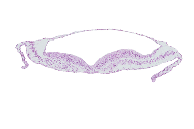 embryonic endoderm, head mesenchyme, neural fold, neural groove, notochordal plate