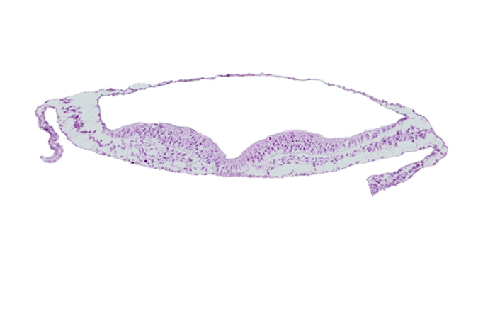 embryonic endoderm, neural fold, neural groove, notochordal plate, presumptive neural crest