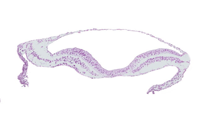 endoderm, neural fold, neural groove, notochordal plate