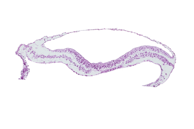 extra-embryonic endoderm, extra-embryonic mesoderm, isolated coelomic space, umbilical vesicle cavity