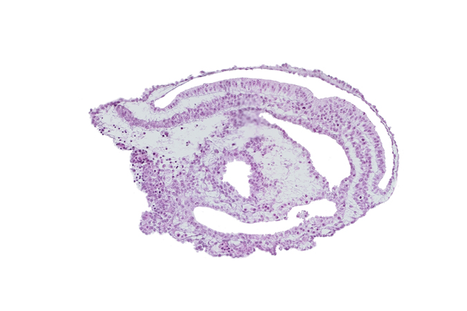 amniotic cavity, extra-embryonic coelom, umbilical vesicle cavity, umbilical vesicle hemangiogenesis