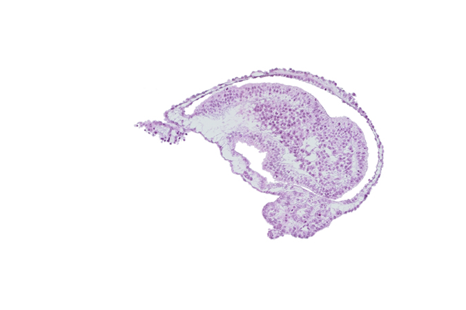 allantoic diverticulum, amnion, amniotic cavity, connecting stalk, extra-embryonic coelom, gastrulation (primitive) groove, gastrulation (primitive) streak