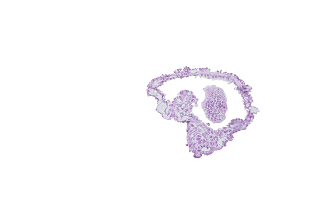 allantoic diverticulum in connecting stalk