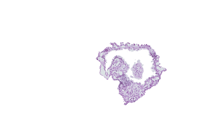 allantoic diverticulum in connecting stalk, amnion, amniotic cavity, caudal eminence