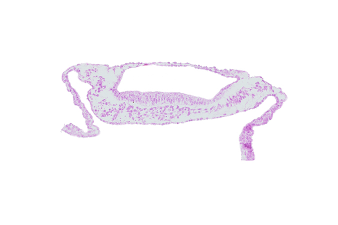 embryonic endoderm, extra-embryonic endoderm, extra-embryonic mesoderm, head mesenchyme, neuroepithelium, neurosomatic junction