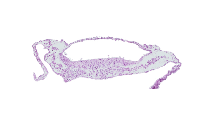 extra-embryonic mesoderm, neural groove, prechordal plate