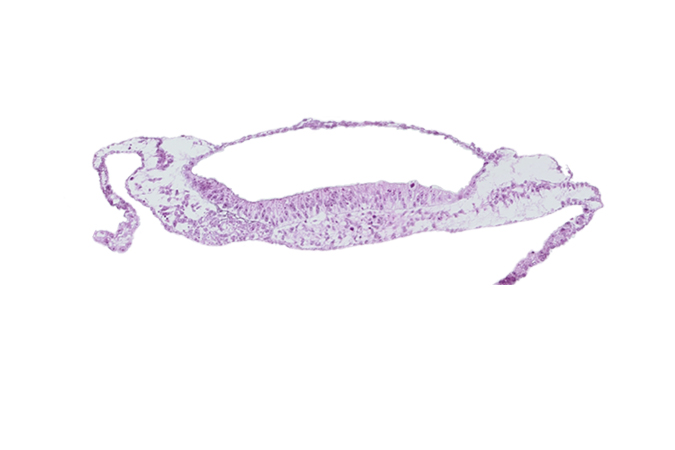 amnion, amniotic cavity, prechordal plate, umbilical vesicle cavity, umbilical vesicle wall