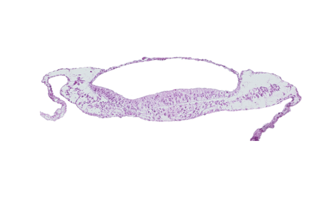 amniotic cavity, prechordal plate